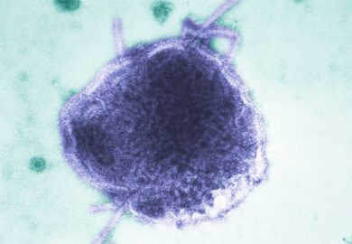 Secretaría de Salud advierte por sarampión: los siete estados que concentran el 85% de los casos en México